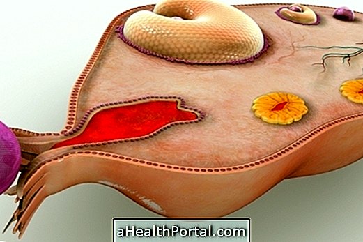 What can be pain in the ovary