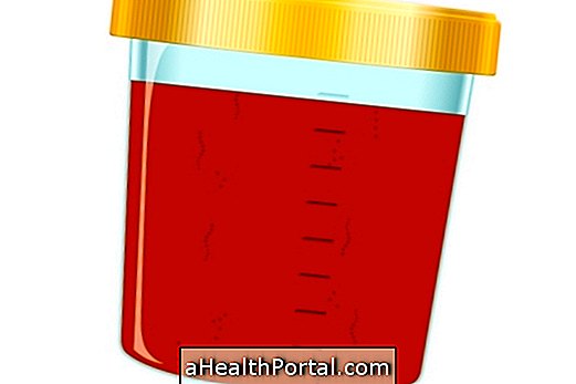 What can be red urine