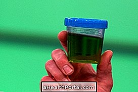 Find out what can leave Green Urine