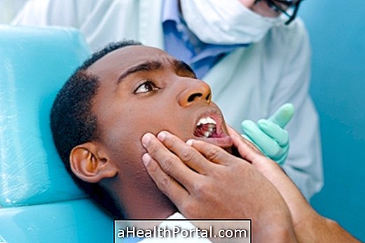 Điều gì có thể gây đau ở hàm