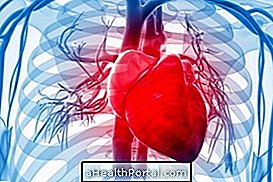 Tachycardia का कारण क्या हो सकता है