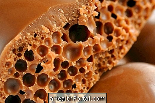 What is Tripophobia and what causes it