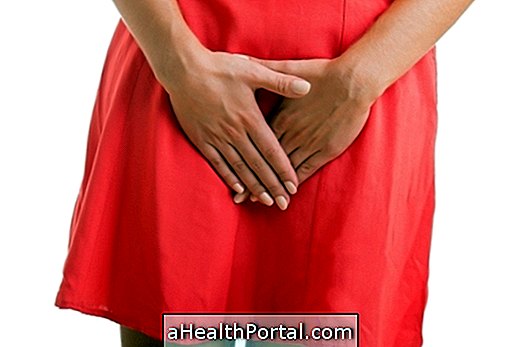 Menstruatsioon veritsus: kuidas tuvastada ja ravida