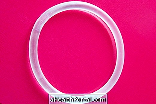 All About The Vaginal Ring