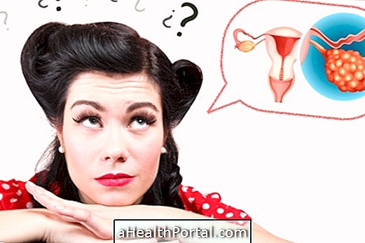 7 Keraguan tentang Ovary Polycystic