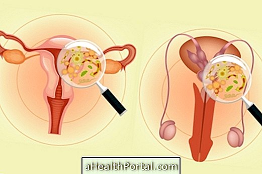 Mi a gonorrhea, tünetek, kezelés és megelőzés