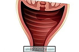 Was sind die Symptome einer vaginalen Candidiasis und wie wird sie behandelt?