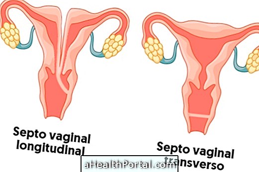 Hvad er vaginal septum og hvordan man behandler det