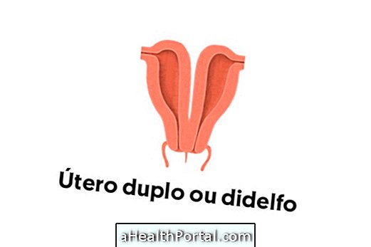 What is uterus didelphus