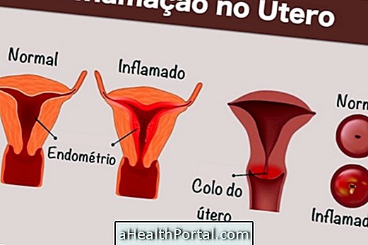 Uterus में सूजन की पहचान और उपचार कैसे करें